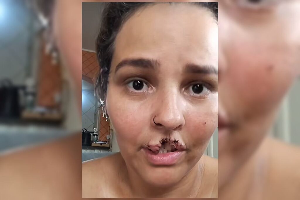 técnica de enfermagem Natani Santos, de 35 anos